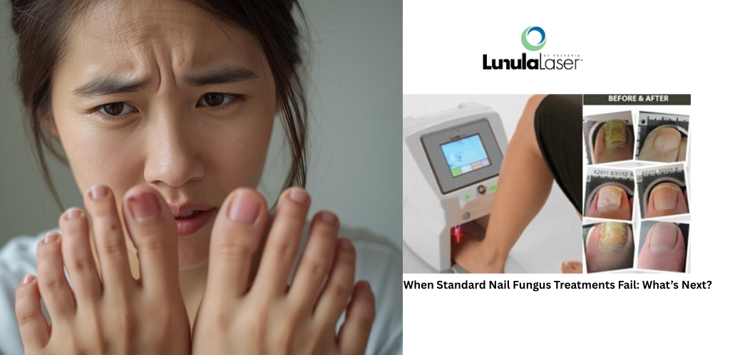 Banner introducing options for patients whose antifungal nail treatment has failed