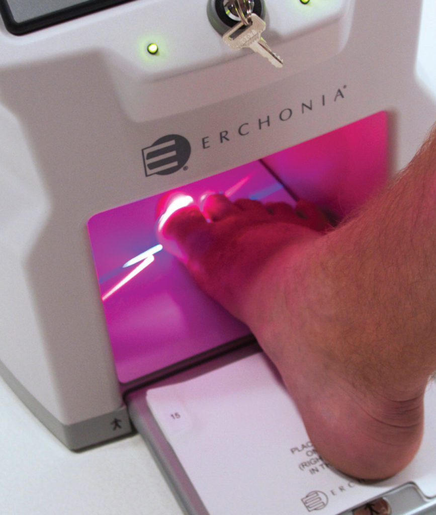 A foot resting on the Erchonia Lunula laser device during a treatment session