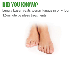 Lunula laser trial promotion banner