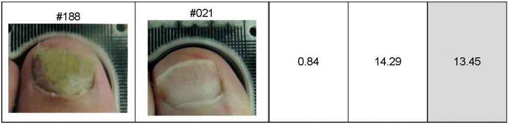 Lunula Clinical Results Summary for Press Release Page 7